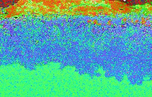 Microscopic heatmap of a corroded material surface